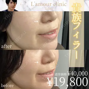 L‘amour clinic Tokyo【ラムールクリニック東京】 片岡 紘士医師の症例