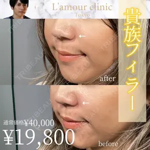 L‘amour clinic Tokyo【ラムールクリニック東京】 片岡 紘士医師の症例