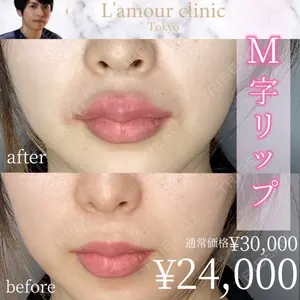 L‘amour clinic Tokyo【ラムールクリニック東京】 片岡 紘士医師の症例