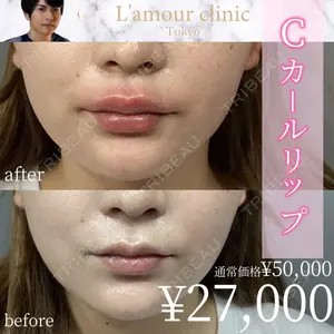 L‘amour clinic Tokyo【ラムールクリニック東京】 片岡 紘士医師の症例