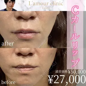 L‘amour clinic Tokyo【ラムールクリニック東京】 片岡 紘士医師の症例