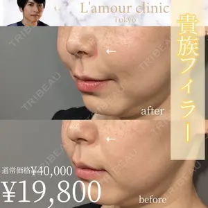 L‘amour clinic Tokyo【ラムールクリニック東京】 片岡 紘士医師の症例