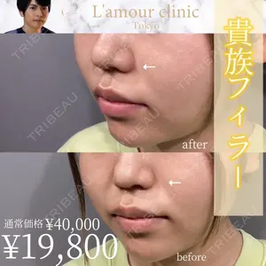 L‘amour clinic Tokyo【ラムールクリニック東京】 片岡 紘士医師の症例