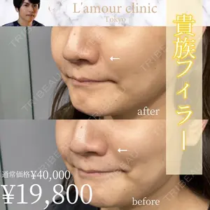 L‘amour clinic Tokyo【ラムールクリニック東京】の症例