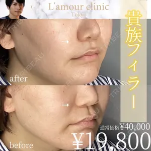 L‘amour clinic Tokyo【ラムールクリニック東京】 片岡 紘士医師の症例