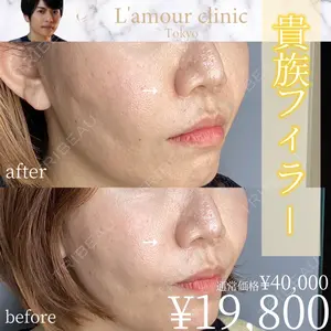 L‘amour clinic Tokyo【ラムールクリニック東京】の症例