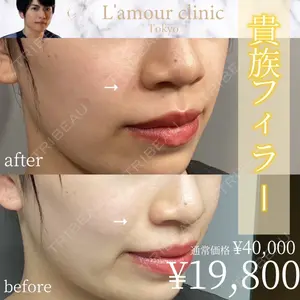 L‘amour clinic Tokyo【ラムールクリニック東京】 片岡 紘士医師の症例