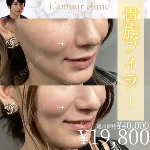 L‘amour clinic Tokyo【ラムールクリニック東京】 片岡 紘士医師の症例