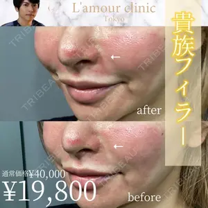 L‘amour clinic Tokyo【ラムールクリニック東京】 片岡 紘士医師の症例