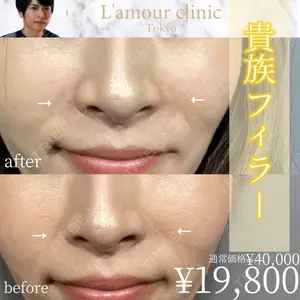 L‘amour clinic Tokyo【ラムールクリニック東京】 片岡 紘士医師の症例