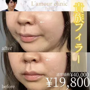 L‘amour clinic Tokyo【ラムールクリニック東京】の症例