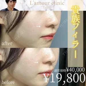 L‘amour clinic Tokyo【ラムールクリニック東京】 片岡 紘士医師の症例