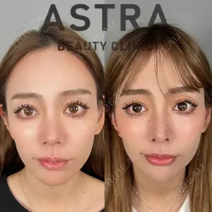 ASTRA BEAUTY CLINIC 塩満 惠子医師の症例