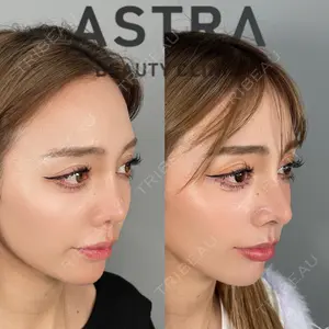 ASTRA BEAUTY CLINIC 塩満 惠子医師の症例