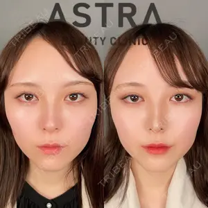 ASTRA BEAUTY CLINICの症例