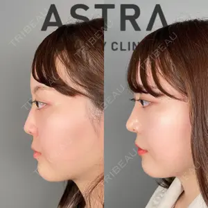 ASTRA BEAUTY CLINICの症例