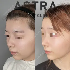 ASTRA BEAUTY CLINICの症例