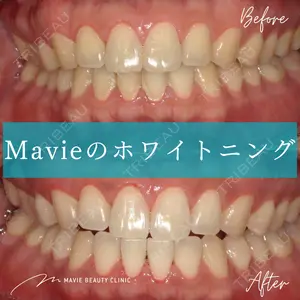 Mavie Beauty Clinic （マヴィービューティークリニック） 渡邉 憲一郎医師の症例