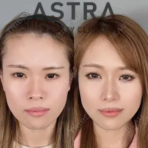 ASTRA BEAUTY CLINIC 塩満 惠子医師の症例