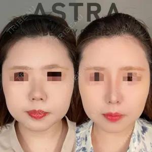 ASTRA BEAUTY CLINIC 塩満 惠子医師の症例