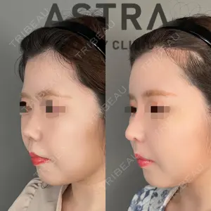 ASTRA BEAUTY CLINIC 塩満 惠子医師の症例