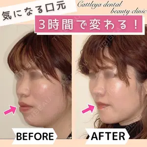 カトレア歯科・美容クリニック 辻 和志医師の症例