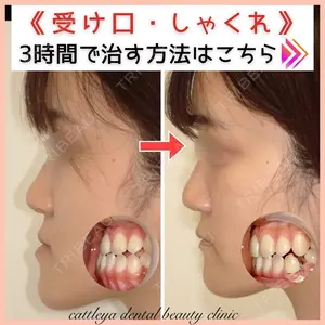 カトレア歯科・美容クリニック 辻 和志医師の症例