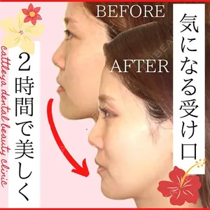 カトレア歯科・美容クリニック 辻 和志医師の症例