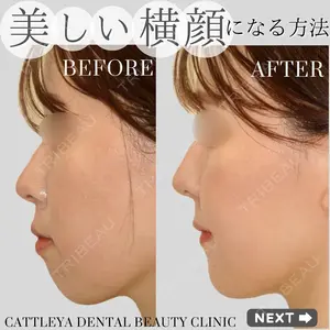 カトレア歯科・美容クリニック 辻 和志医師の症例