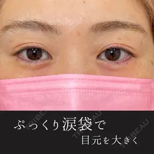 ルラ美容クリニック 渋谷本院 昼間 路子医師の症例