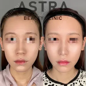 ASTRA BEAUTY CLINIC 塩満 惠子医師の症例