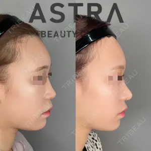 ASTRA BEAUTY CLINIC 塩満 惠子医師の症例