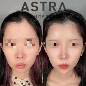 ASTRA BEAUTY CLINIC 塩満 惠子医師の症例