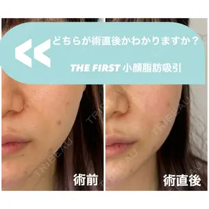 THE FIRST CLINIC 多摩センター院 惟村 公郁医師の症例