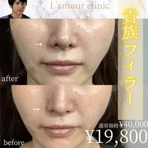 L‘amour clinic Tokyo【ラムールクリニック東京】 片岡 紘士医師の症例