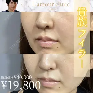 L‘amour clinic Tokyo【ラムールクリニック東京】 片岡 紘士医師の症例