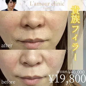 L‘amour clinic Tokyo【ラムールクリニック東京】 片岡 紘士医師の症例