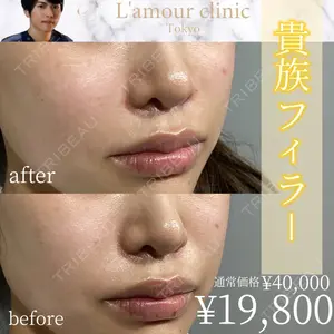 L‘amour clinic Tokyo【ラムールクリニック東京】 片岡 紘士医師の症例