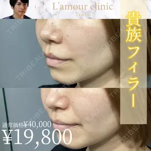 L‘amour clinic Tokyo【ラムールクリニック東京】 片岡 紘士医師の症例