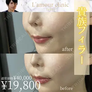 L‘amour clinic Tokyo【ラムールクリニック東京】 片岡 紘士医師の症例