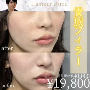 L‘amour clinic Tokyo【ラムールクリニック東京】 片岡 紘士医師の症例