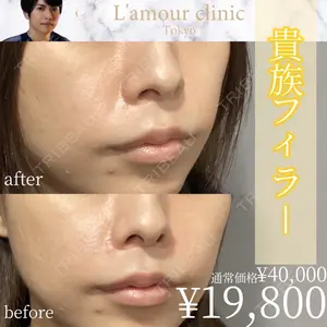 L‘amour clinic Tokyo【ラムールクリニック東京】 片岡 紘士医師の症例