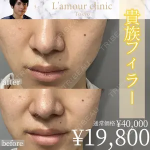 L‘amour clinic Tokyo【ラムールクリニック東京】の症例