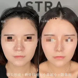 ASTRA BEAUTY CLINIC 塩満 惠子医師の症例