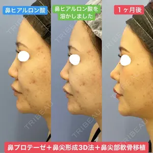 湘南美容クリニック 銀座院 葛島 魁人医師の症例