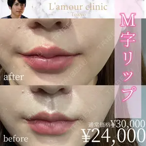 L‘amour clinic Tokyo【ラムールクリニック東京】 片岡 紘士医師の症例