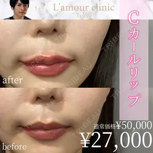 L‘amour clinic Tokyo【ラムールクリニック東京】 片岡 紘士医師の症例