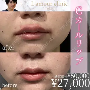 L‘amour clinic Tokyo【ラムールクリニック東京】 片岡 紘士医師の症例