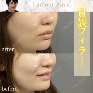 L‘amour clinic Tokyo【ラムールクリニック東京】 片岡 紘士医師の症例