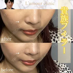 L‘amour clinic Tokyo【ラムールクリニック東京】 片岡 紘士医師の症例